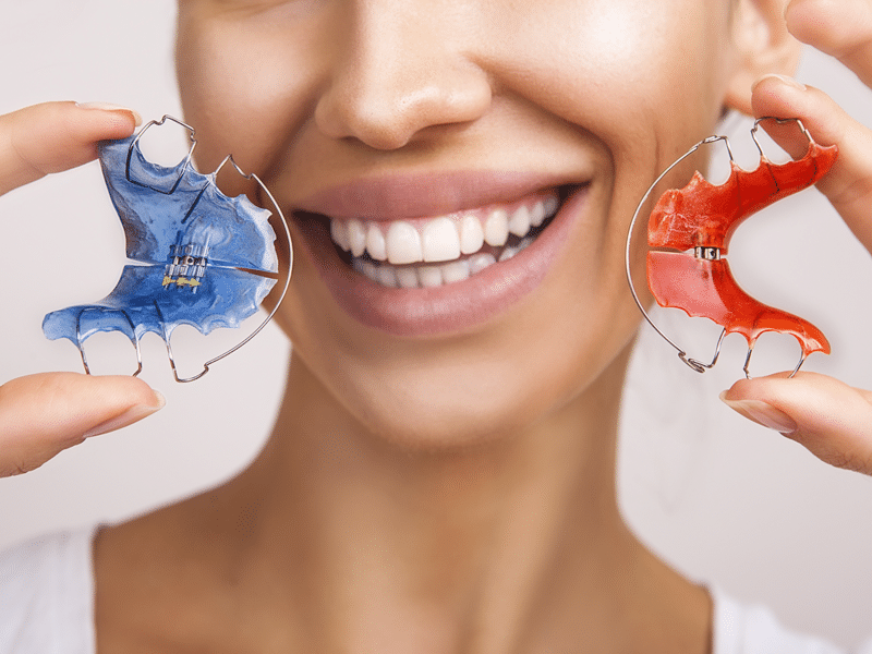 Has Your Dentist Suggested You Wear A Retainer? – Here Are 5 Questions You Should Ask